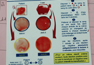 Transfusion